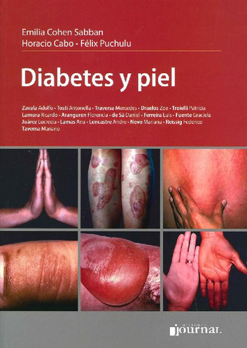 Libro Diabetes Y Piel De Horacio Cabo Emilia Cohen Félix Puc