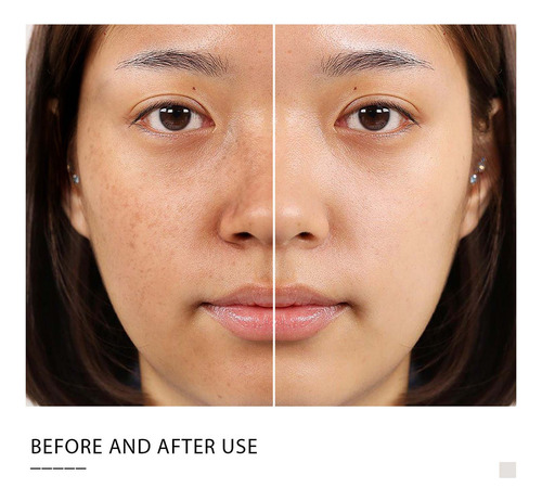 E Crema Facial Refrescante Facial Para Mujer Facial Moi 5010