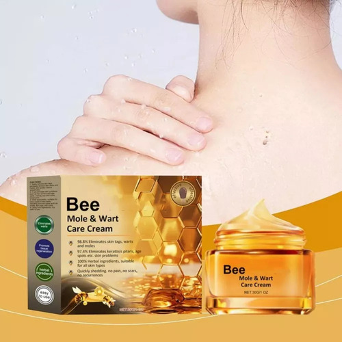 Kyl Z Bee Crema Antiverrugas Eliminar Verrugas Y Res