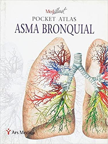 Pocket Atlas Asma Bronquial, De Medillust. Editorial Ergon, Tapa Blanda En Español, 2008