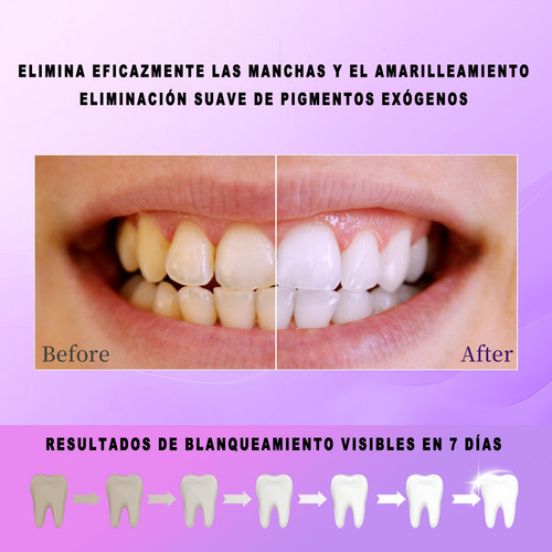 Eliminación De Manchas Polvo Blanqueador Dientes Uva Menta