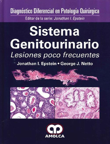 Libro Sistema Genitourinario. Lesiones Poco Frecuentes De Ge