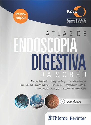 Atlas de Endoscopia Digestiva da SOBED, de Averbach, Marcelo. Editora Thieme Revinter Publicações Ltda, capa dura em português, 2020