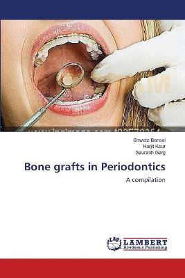 Libro Bone Grafts In Periodontics - Shweta Bansal