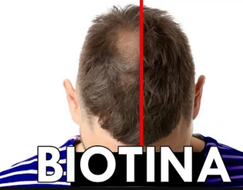 Imagen 3 de 9 de Ampolla Biotina Caida Cabello Uso Dermapen Electroporacion