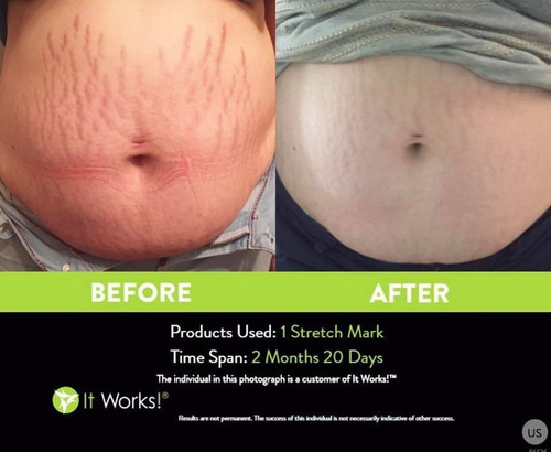 Parches Reductivos Toning Body Wrap It Works 3 Pzas + Regalo