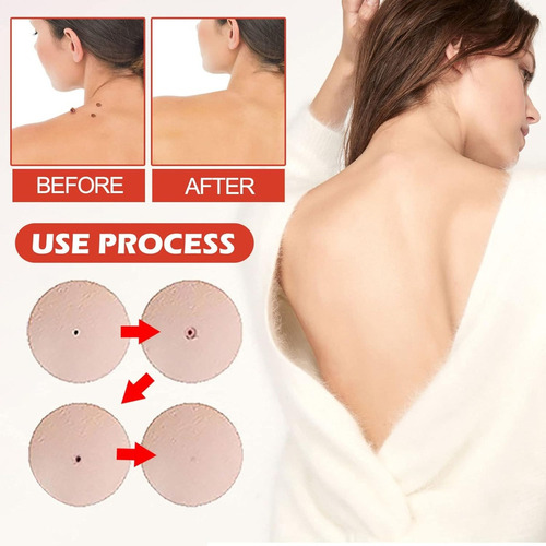 Microdarts Nano Patch,parche Para El Cuidado Facial (1 Caja)