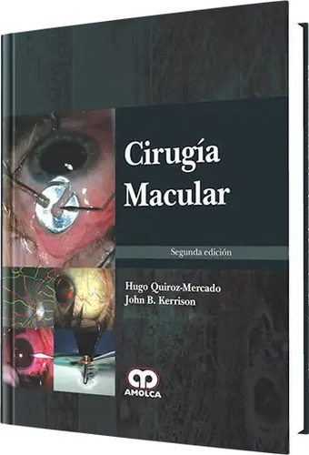 Cirugía Macular 2 Ed Quiroz-mercado