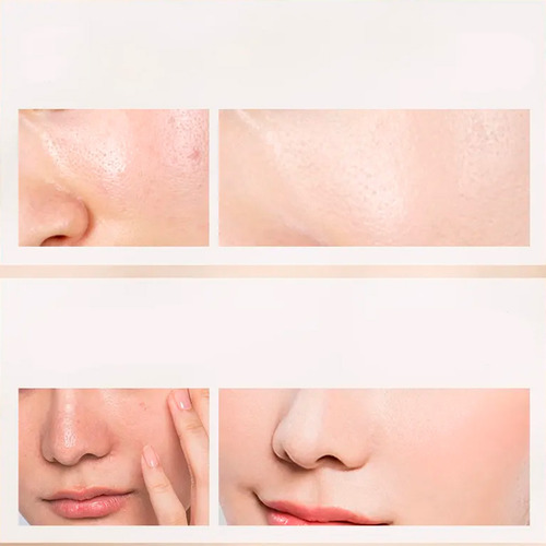 Set Facial Sadoer 7 Pz Con Miel Hidratante Antiedad Skincare Todo Tipo De Piel Día/noche