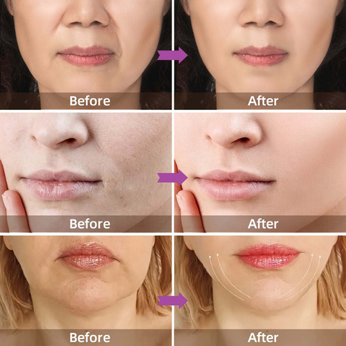 Y Face Lift Cream Crema De Día Y Noche Y Antiarrugas 2003