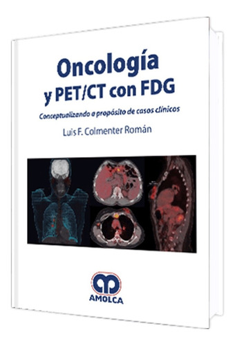 Oncología Y Pet/ct Con F D G  Conceptualizando Casos. Amolca