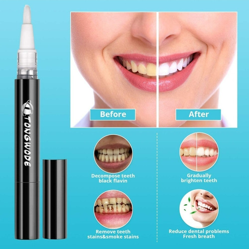 Kit De Blanqueamiento Dental. Férula Luz Led Peróxido