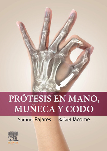 Libro: Protesis En Mano Muñeca Y Codo. Pajares, Samuel/jacom