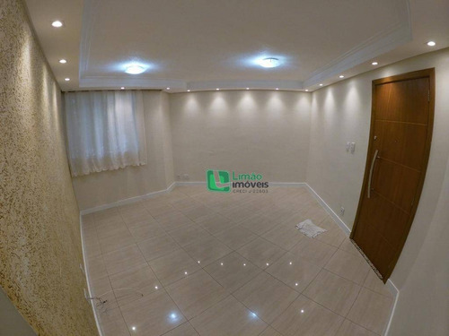 Imagem 1 de 20 de Apartamento Com 2 Dormitórios À Venda, 58 M² Por R$ 280.000,00 - Limão (zona Norte) - São Paulo/sp - Ap1315