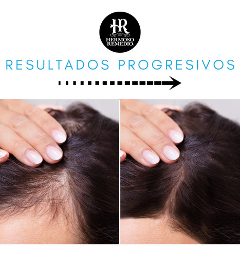 18 Shampoo Crecimiento Anticaída Caspa Reparador Hombre 7en1