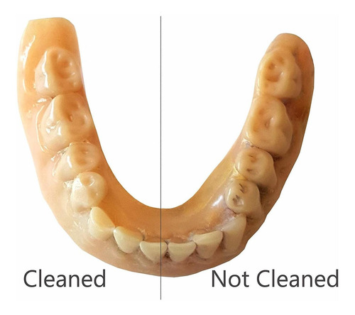Isonic F3900 Ultrasónico Dentales / Alineador / Retenedor Cl