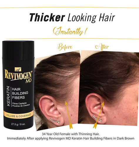 Fibras De Queratina Para El Cabello, Relleno - Revivogenmd