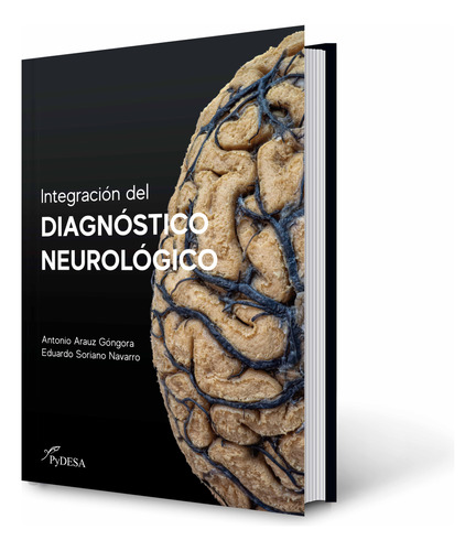 Integración Del Diagnóstico Neurológico *versión Pasta Dura