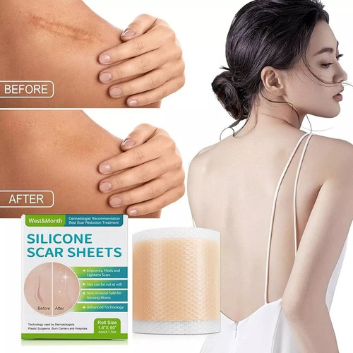 Silicona Cicatriz Abdominoplastia Dermo Cesarea Post Parto