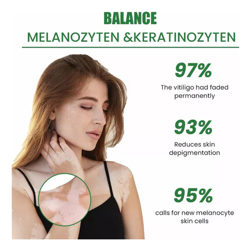 . Pomada Blanca Para El Vitíligo, Crema Para La Micosis, Leu