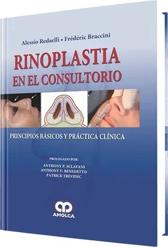 Rinoplastia En El Consultorio Principios Básicos Y Práctica 