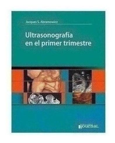 Ultrasonografía En El Primer Trimestre. - Abramowicz, Jacqu