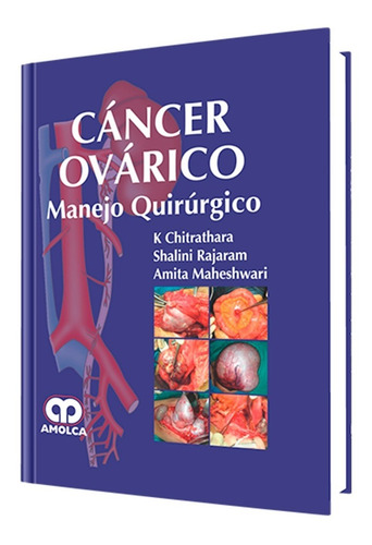 Cáncer Ovárico. Manejo Quirúrgico. Editorial Amolca.