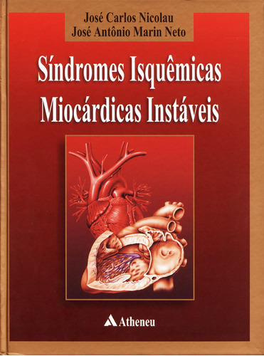 Síndrome isquêmicas miocárdicas instáveis, de Nicolau, José Carlos. Editora Atheneu Ltda, capa mole em português, 2001