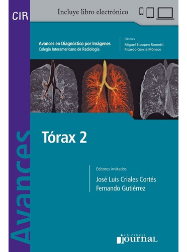 Torax 2 Avances En Diagnostico Por Imagen