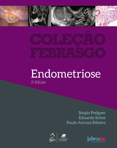 Coleção Febrasgo - Endometriose, de Podgaec, Sérgio. Editorial GEN Guanabara Koogan, capa mole em português, 2019