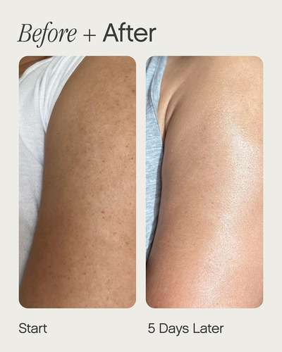 Los Tópicos Se Unen Suero Del Cuerpo Exfoliante: Con Urea Y