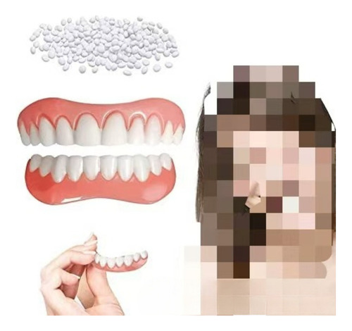 Aparatos Dentales Simulados Instantsmile
