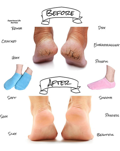 Calcetines Hidratantes, Calcetines De Gel Hidratantes, Calce