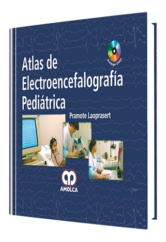 Atlas De Electroencefalografía Pediátrica.