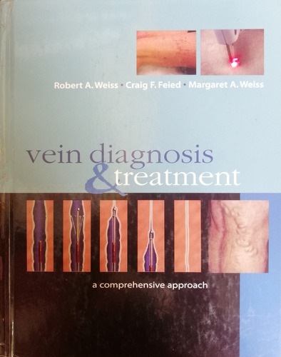 Vein Diagnosis & Treatment: A Comprehensive Approach 1st Edi