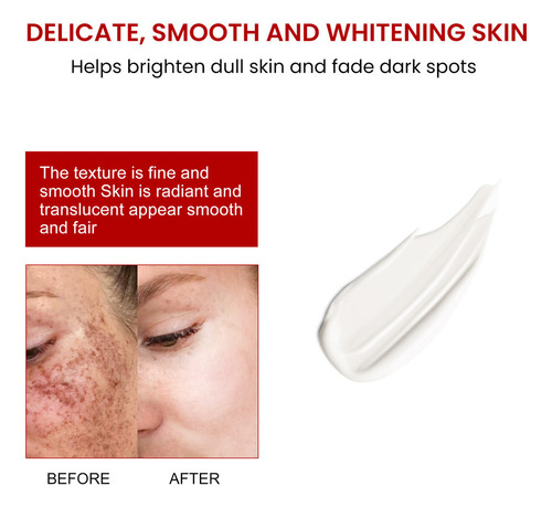 4×removedor Manchas Escuras,sardas Melasma,manchas Sol