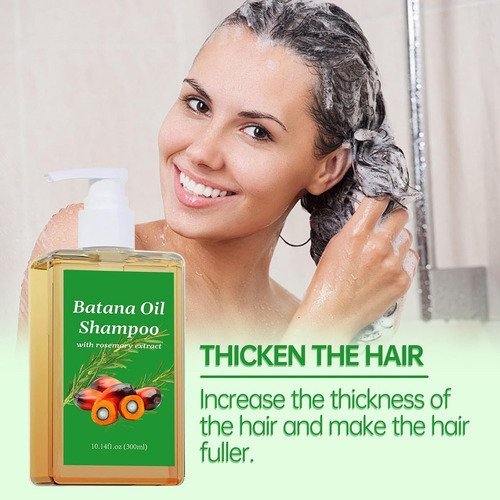 . Shampoo De Alecrim, Reduz A Perda De Cabelo, Macio E