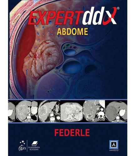  Expertddx Abdome Serie Expert Differential Diagnoses Capa Dura Autor: Federle