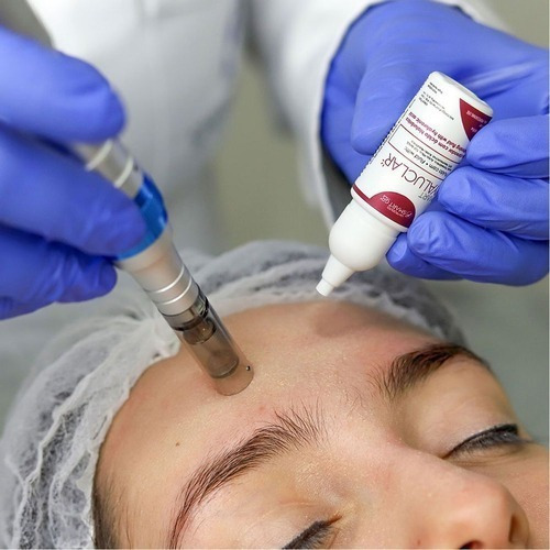 Hyaluclar Micro Clareador Ácido Hialurônico 5ml Monodose Momento de aplicação Dia/Noite Tipo de pele Todo tipo de pele