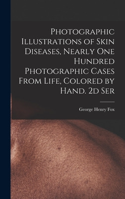 Libro Photographic Illustrations Of Skin Diseases, Nearly...