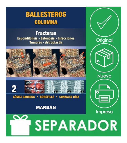 Ballesteros. Columna Tomo 2: Fracturas, De Ballesteros. Editorial Marbán, Tapa Blanda, Edición 1ra En Español, 2021