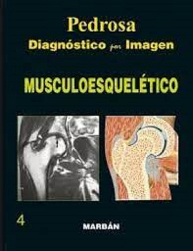 Pedrosa Diagnostico Por Imagen Musculoesqueletico