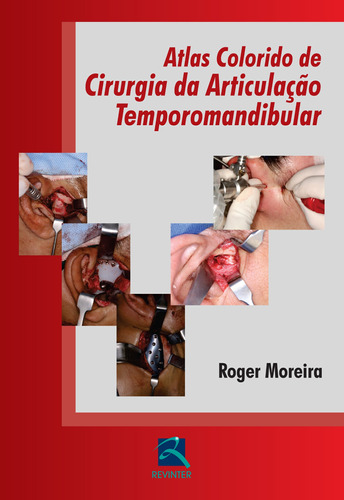 Atlas Colorido de Cirurgia da ATM, de Moreira, Roger. Editora Thieme Revinter Publicações Ltda, capa dura em português, 2015