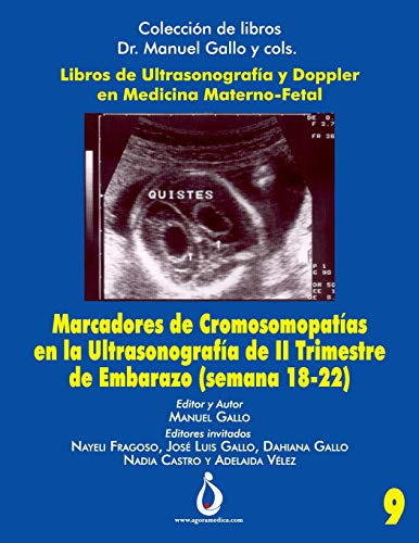 Marcadores Cromosomopatias En La Ultrasonografia De Ii Trime