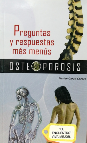 Osteoporosis/ Preguntas Y Respuestas/ Más Menús/marien Garza