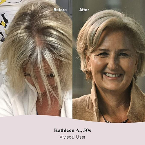Imagen 4 de 5 de Viviscal, Woman Advanced Hair Health. 60 Tabletas.