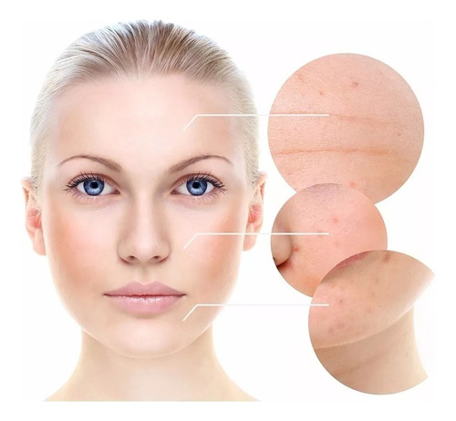 Serum Niacinamide 10% Anti Age Multi Accion - Idraet Todo Tipo De Piel Día/noche