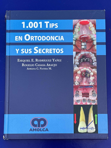 1001 Tips En Ortodoncia Y Sus Secretos