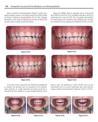 Ortopedia Funcional De Los Maxilares En Odontopediatría. Incluye E-book: Rehabilitación Neuroclusal Precoz, De Margarita Ponce Palomares. Editorial Amolca, Tapa Dura, Edición 1 En Español, 2024