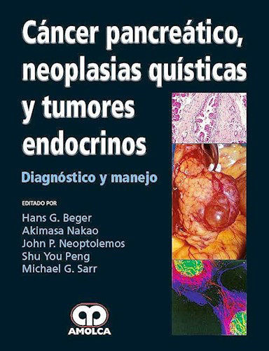 Cancer Pancreatico Neoplasias Quisticas Y Tumores